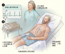 冠心病需要做哪些檢查?